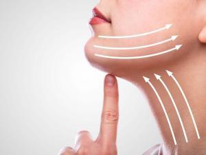 Does a non-surgical facelift really work image. Showing the areas that are usually lifted to give that effect of a facelift without the need for an operation.