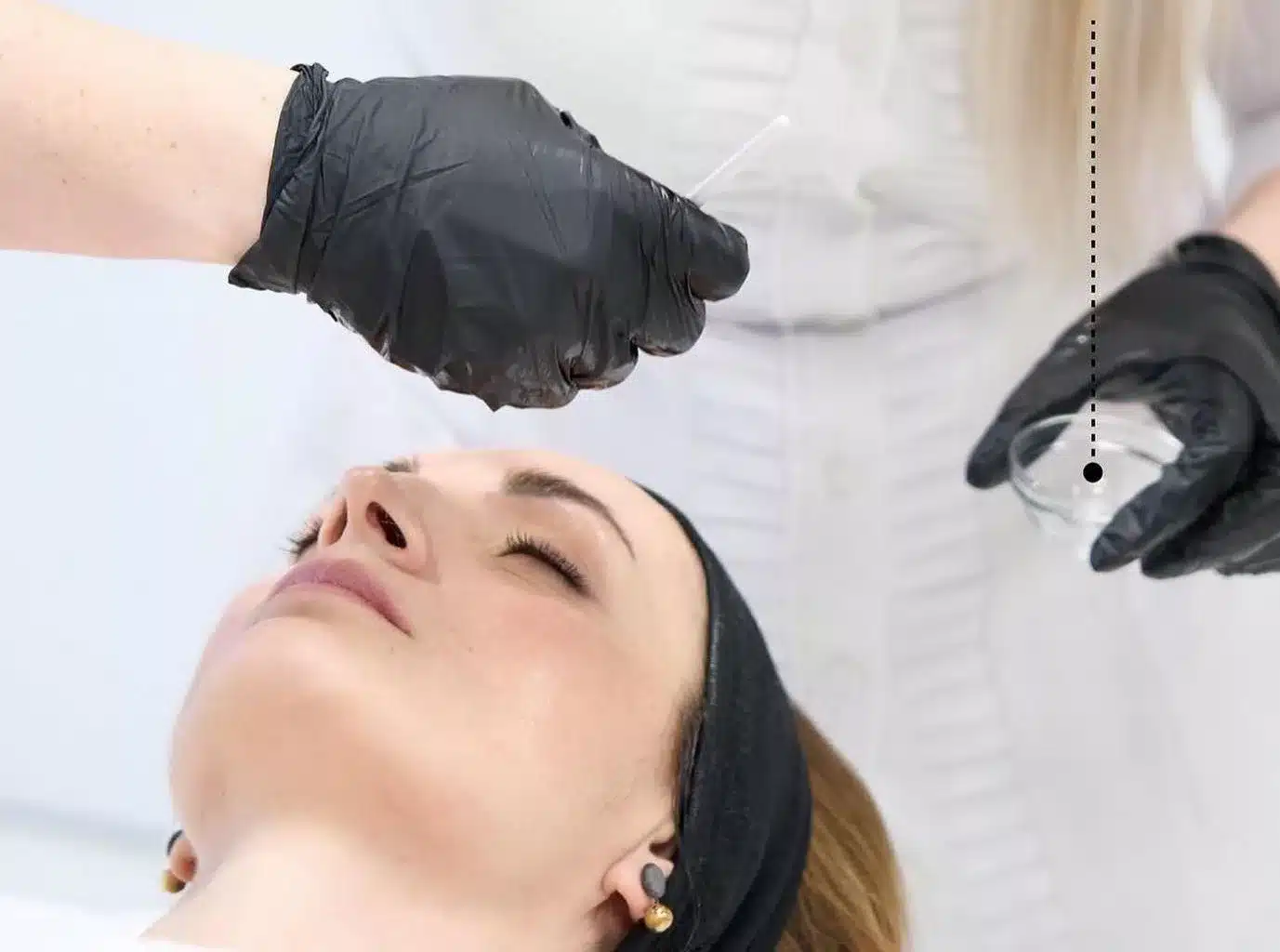 Over-exfoliated skin? Here’s how to heal your barrier and get your glow back (without overdoing it)! 1 phformula image jpg